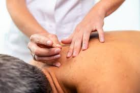 dry needling therapie